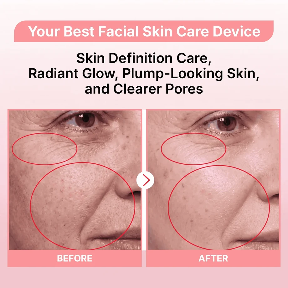 GloWand before and after appearance comparison